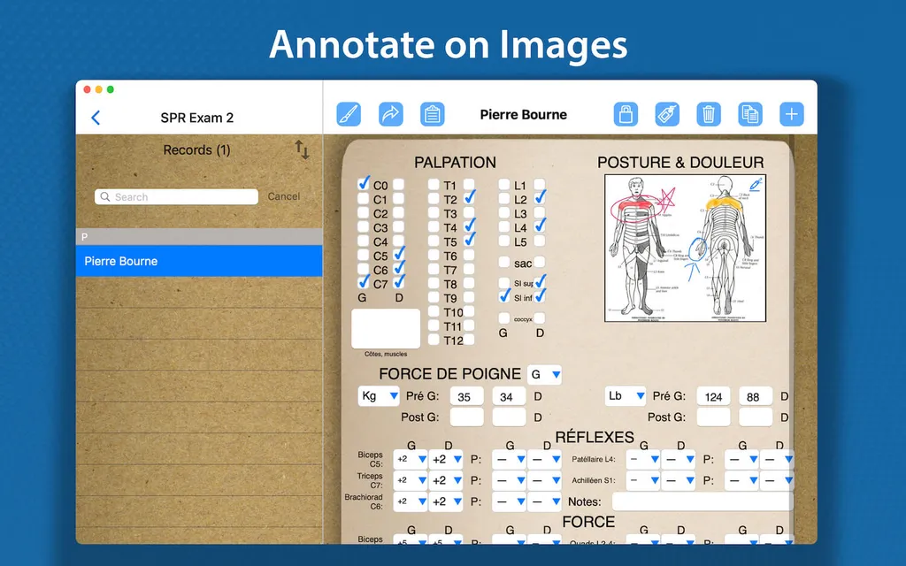 Annotating an image with notes in FormConnect